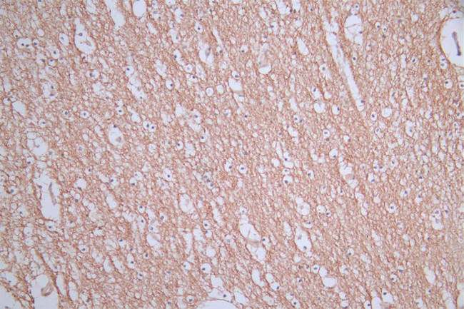 CD171 Antibody in Immunohistochemistry (Paraffin) (IHC (P))