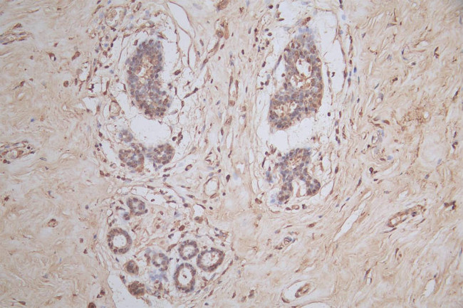 SNRPD1 Antibody in Immunohistochemistry (Paraffin) (IHC (P))