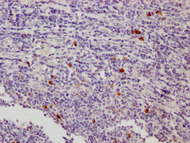 CD223 Antibody in Immunohistochemistry (Paraffin) (IHC (P))