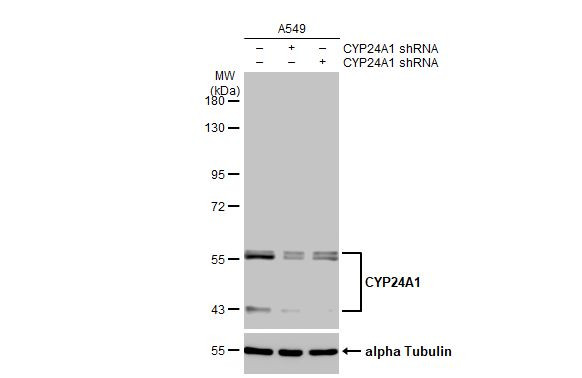 CYP24A1 Antibody in Western Blot (WB)