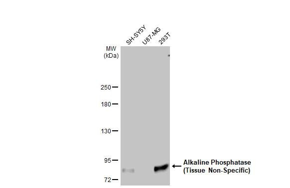 ALPL Antibody in Western Blot (WB)