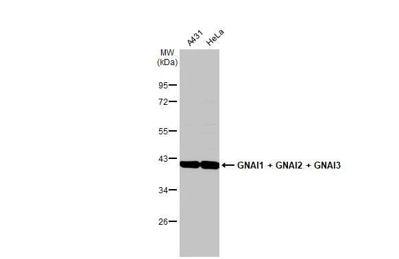GNAI1/GNAI2/GNAI3 Antibody in Western Blot (WB)