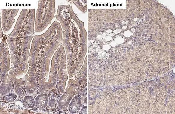 GNAI3 Antibody in Immunohistochemistry (Paraffin) (IHC (P))