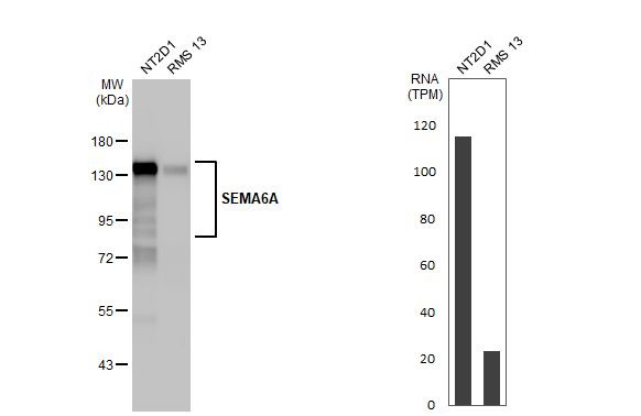 SEMA6A Antibody in Western Blot (WB)