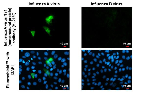 Influenza A H1N1 HA (A/California/07/2009) Antibody in Immunocytochemistry (ICC/IF)