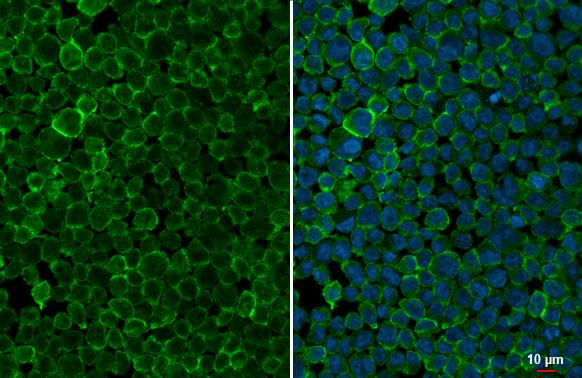 Pepsinogen I Antibody in Immunocytochemistry (ICC/IF)