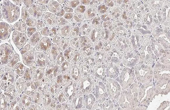 SERPINB2 Antibody in Immunohistochemistry (Paraffin) (IHC (P))