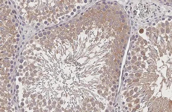 GPS2 Antibody in Immunohistochemistry (Paraffin) (IHC (P))