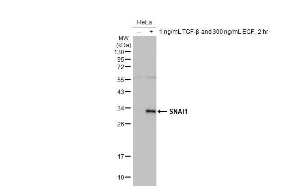 SNAIL Antibody in Western Blot (WB)