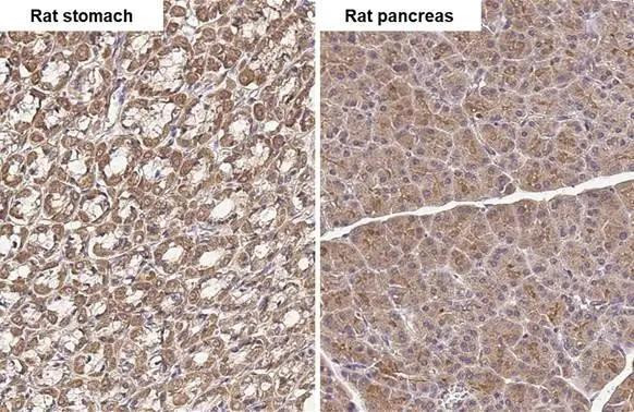 TLR3 Antibody in Immunohistochemistry (Paraffin) (IHC (P))