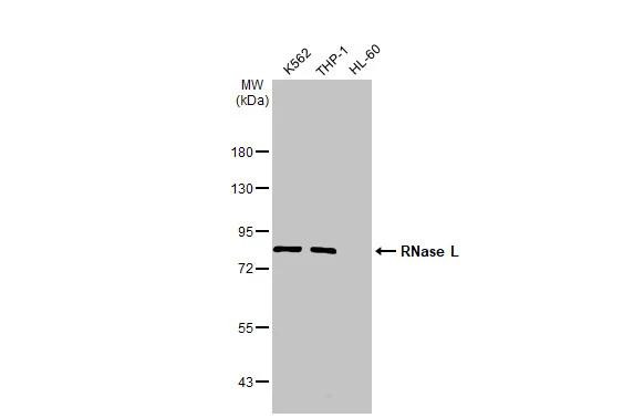 RNaseL Antibody in Western Blot (WB)