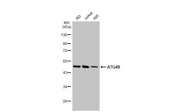 ATG4B Antibody in Western Blot (WB)