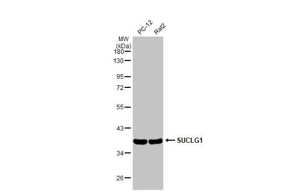 SUCLG1 Antibody in Western Blot (WB)