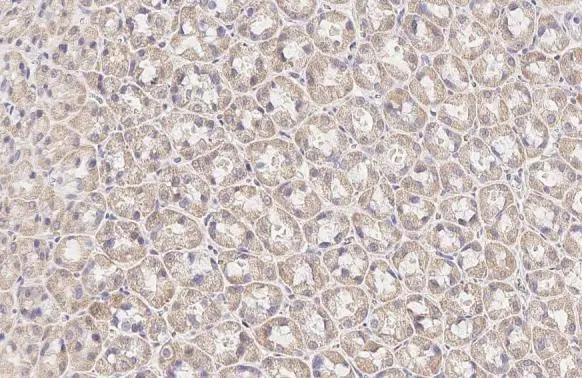 BCKDHA Antibody in Immunohistochemistry (Paraffin) (IHC (P))