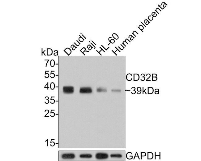 CD32b Antibody in Western Blot (WB)