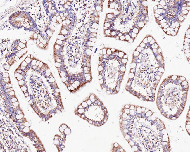 CUX1/Protein CASP Antibody in Immunohistochemistry (Paraffin) (IHC (P))