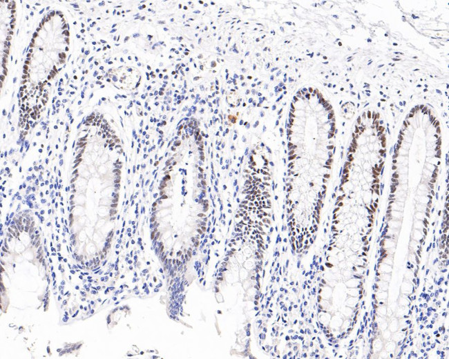 FOXP1 Antibody in Immunohistochemistry (Paraffin) (IHC (P))