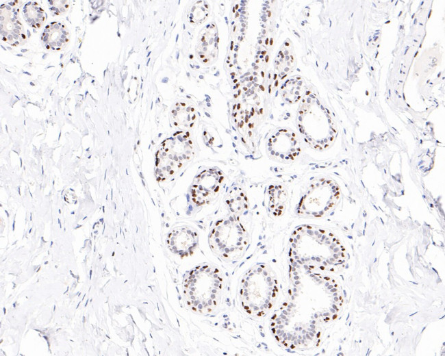 FOXP1 Antibody in Immunohistochemistry (Paraffin) (IHC (P))