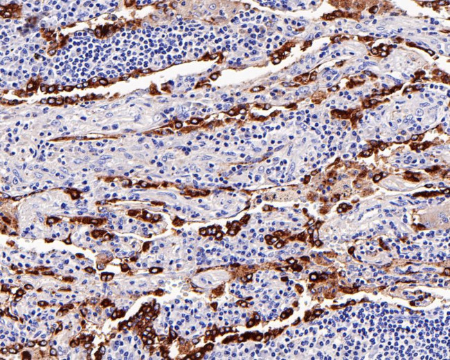 NAPSA Antibody in Immunohistochemistry (Paraffin) (IHC (P))