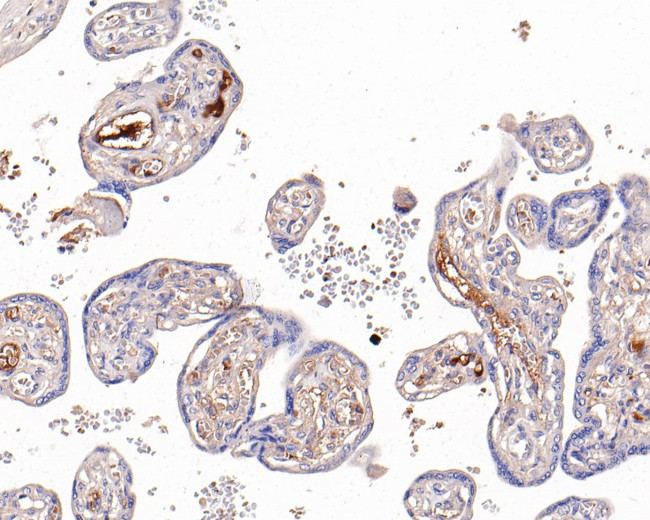 AFP Antibody in Immunohistochemistry (Paraffin) (IHC (P))