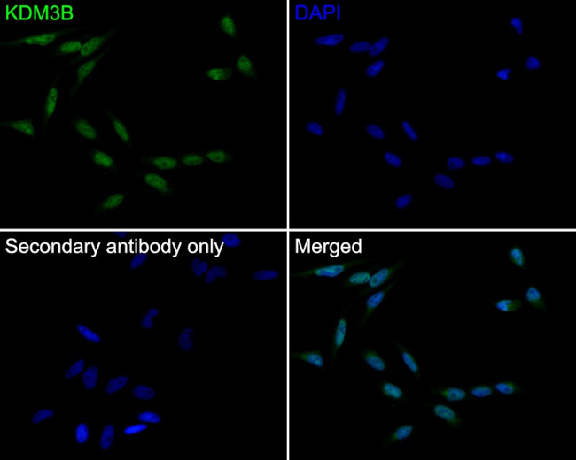 JMJD1B Antibody in Immunocytochemistry (ICC/IF)