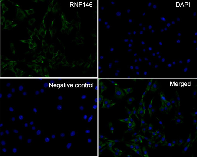RNF146 Antibody in Immunocytochemistry (ICC/IF)