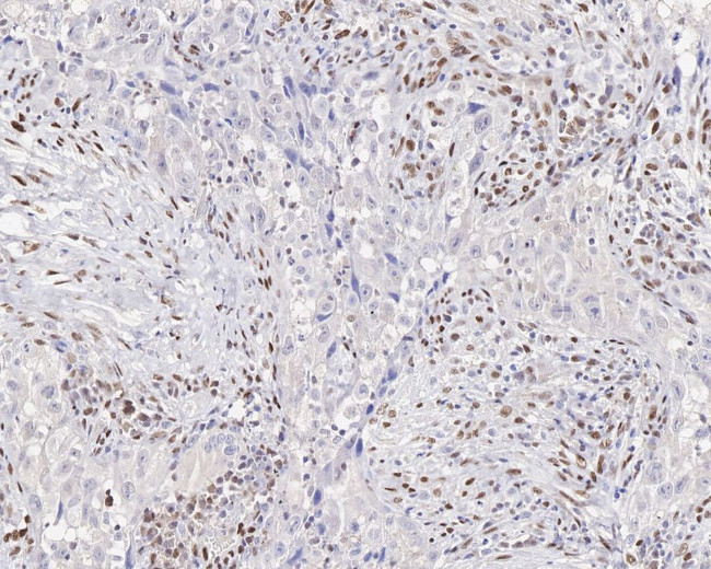 ZEB1 Antibody in Immunohistochemistry (Paraffin) (IHC (P))