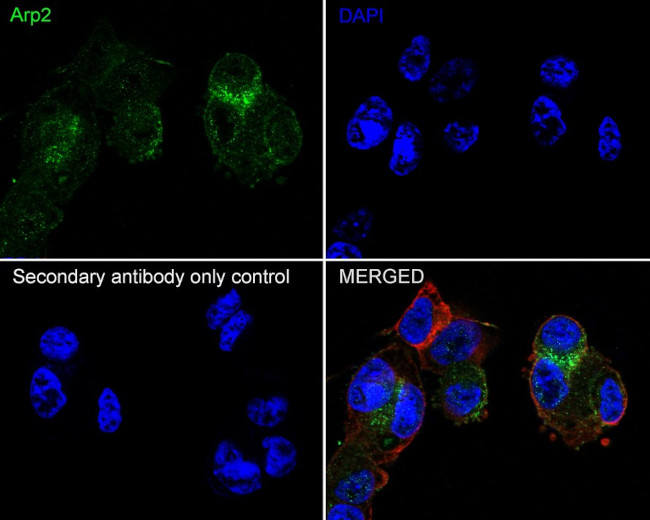 Arp2 Antibody in Immunocytochemistry (ICC/IF)