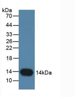 Cystatin B Antibody in Western Blot (WB)