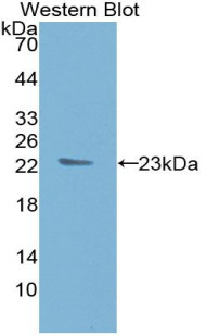 TIMP1 Antibody in Western Blot (WB)