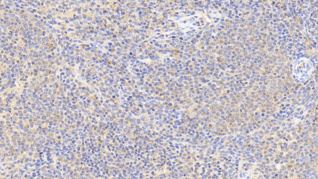 Cofilin Antibody in Immunohistochemistry (Paraffin) (IHC (P))