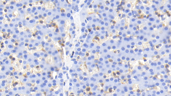 Cofilin Antibody in Immunohistochemistry (Paraffin) (IHC (P))