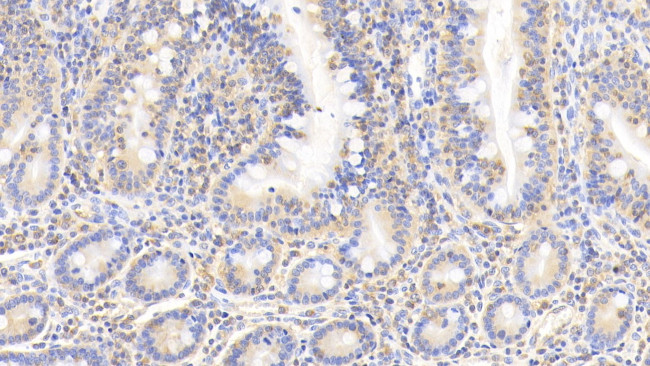 Cofilin Antibody in Immunohistochemistry (Paraffin) (IHC (P))