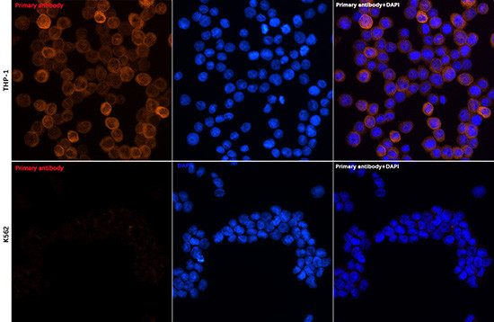 CHI3L1 Antibody in Immunocytochemistry (ICC/IF)