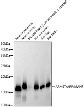 ARMET Antibody in Western Blot (WB)