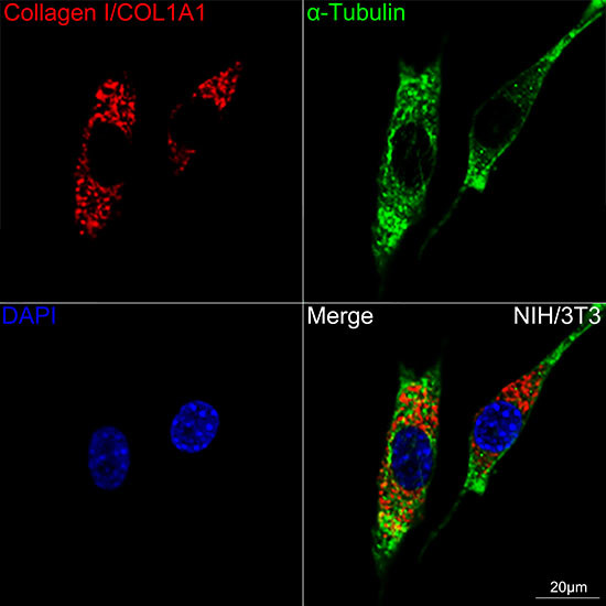 COL1A1 Antibody in Immunocytochemistry (ICC/IF)