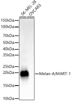 Melan-A Antibody in Western Blot (WB)