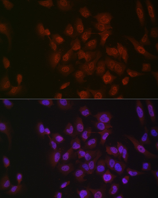 Phospho-p38 MAPK alpha (Tyr182) Antibody in Immunocytochemistry (ICC/IF)