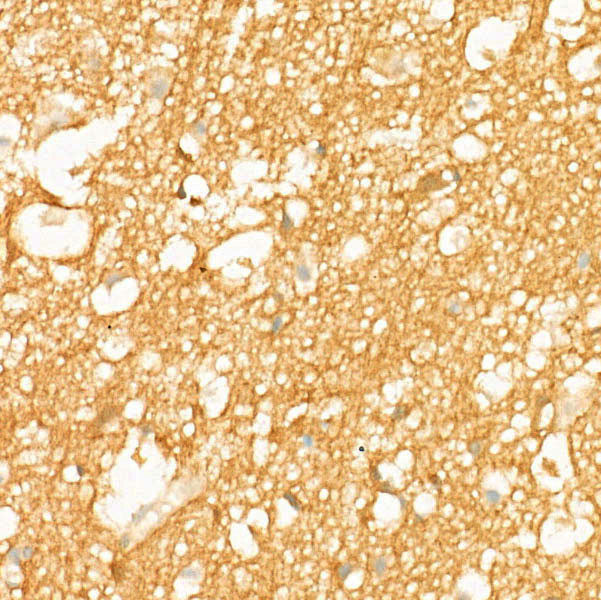 CD171 Antibody in Immunohistochemistry (Paraffin) (IHC (P))