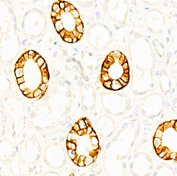 CD171 Antibody in Immunohistochemistry (Paraffin) (IHC (P))