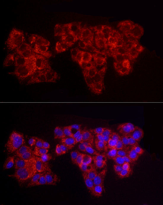 ACSL1 Antibody in Immunocytochemistry (ICC/IF)