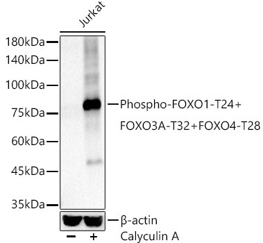 Phospho-FOXO1/FOXO3/FOXO4 (Thr24, Thr32, Thr28) Antibody in Western Blot (WB)