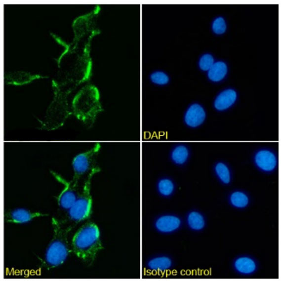 NMDAR2B Chimeric Antibody in Immunocytochemistry (ICC/IF)