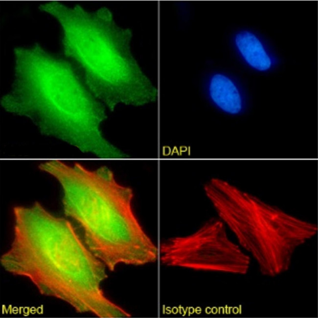 MAGEA3 Chimeric Antibody in Immunocytochemistry (ICC/IF)