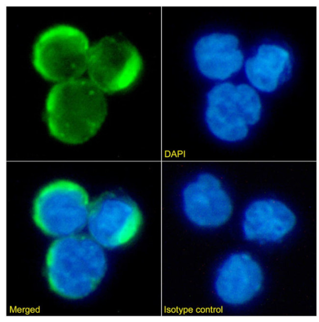 CCR5 Antibody in Immunocytochemistry (ICC/IF)