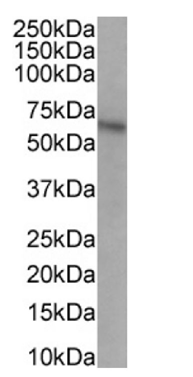 CCR5 Antibody in Western Blot (WB)