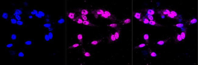 CRTC3 Antibody in Immunocytochemistry (ICC/IF)