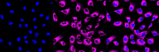 HDLBP Antibody in Immunocytochemistry (ICC/IF)