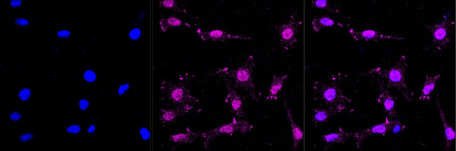 Band 3 Antibody in Immunocytochemistry (ICC/IF)