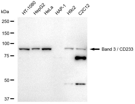 Band 3 Antibody in Western Blot (WB)